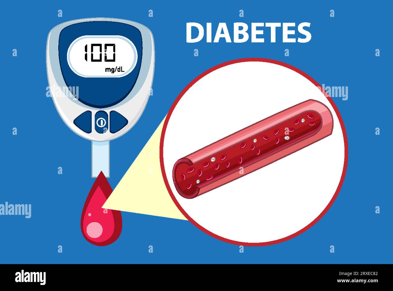 Illustration of a glucose meter device used to check blood sugar levels