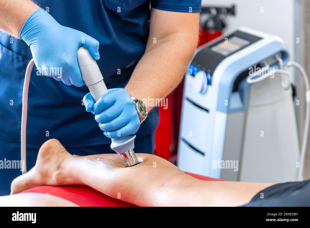 Physical therapy of the shin with shock wave, extracorporeal shockwave therapy. Stock Photo