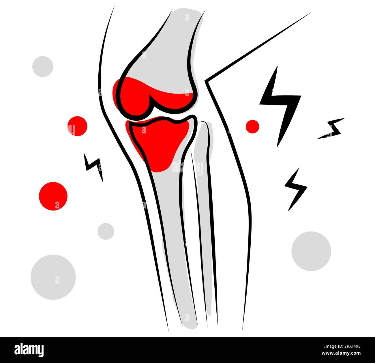 Knee pain. Vector illustration Stock Vector Image & Art - Alamy