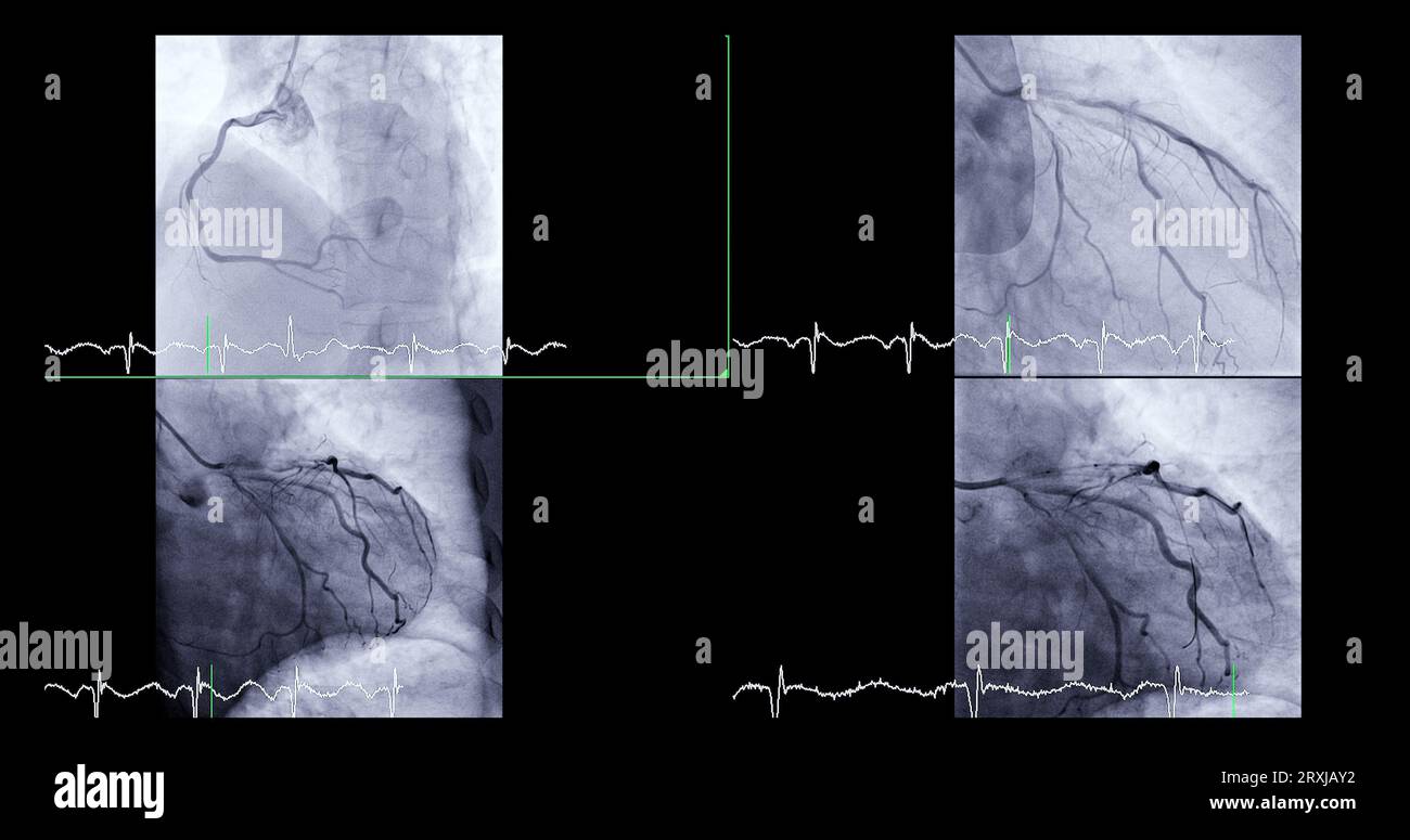 Cardiac catheterization can help doctor diagnose and treat problems in