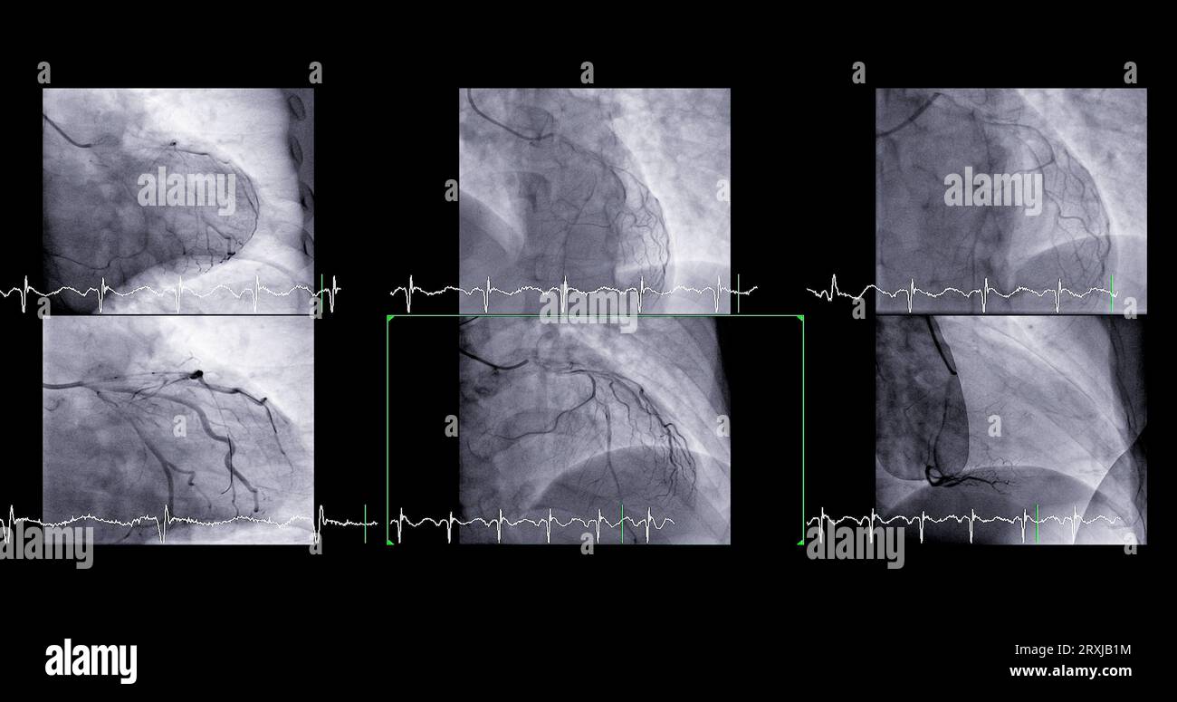 Cardiac catheterization can help doctor diagnose and treat problems in