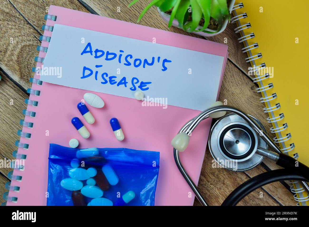 Concept of Addison's Disease write on sticky notes with stethoscope ...