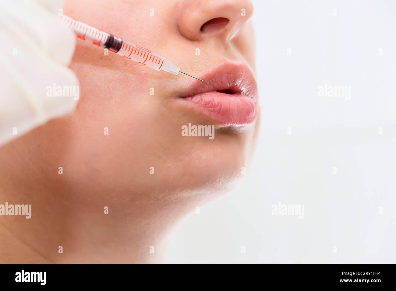 Closeup of beautiful mouth and lips with botox and syringe Stock Photo