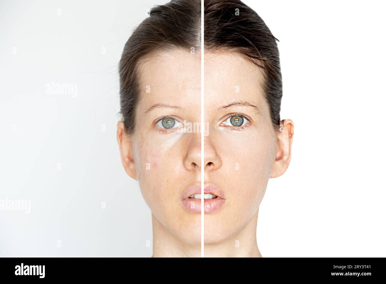 The face of a young girl with frequency processing of one half of the ...