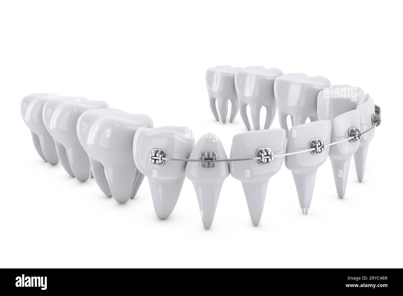 Braces mouth brackets Cut Out Stock Images & Pictures Alamy