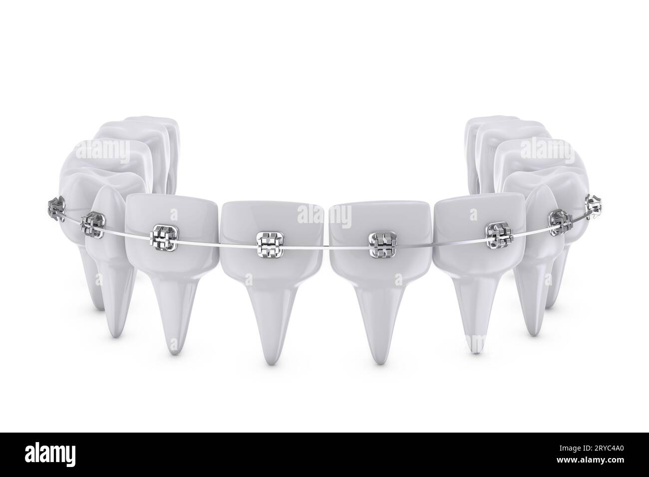 Braces mouth brackets Cut Out Stock Images & Pictures Alamy