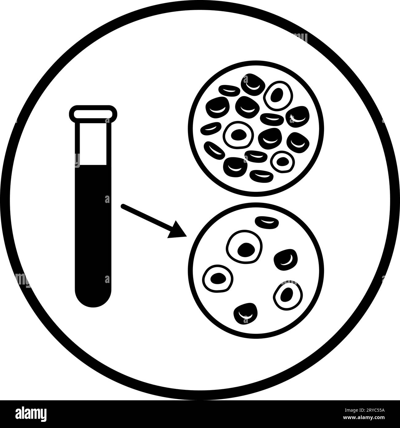 Anemia: blood test comparison between healthy blood and anemic blood, isolated icon Stock Vector