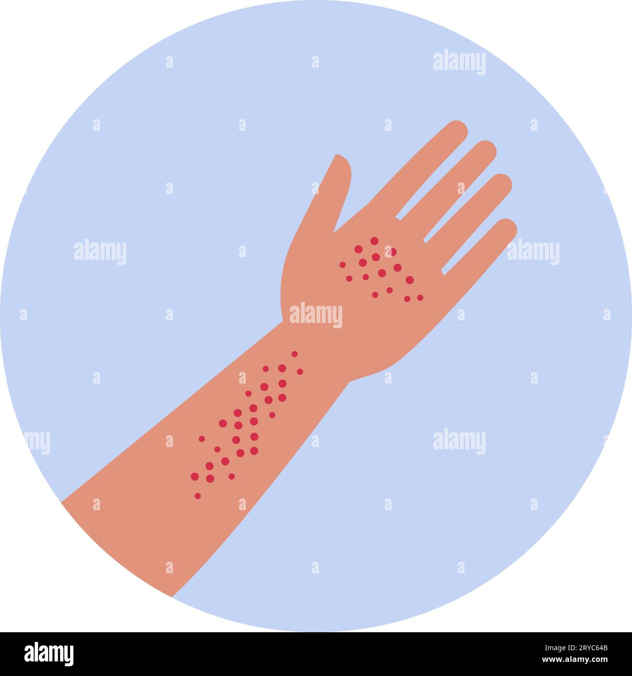 Rash on hand and arm skin, isolated medical icon Stock Vector Image