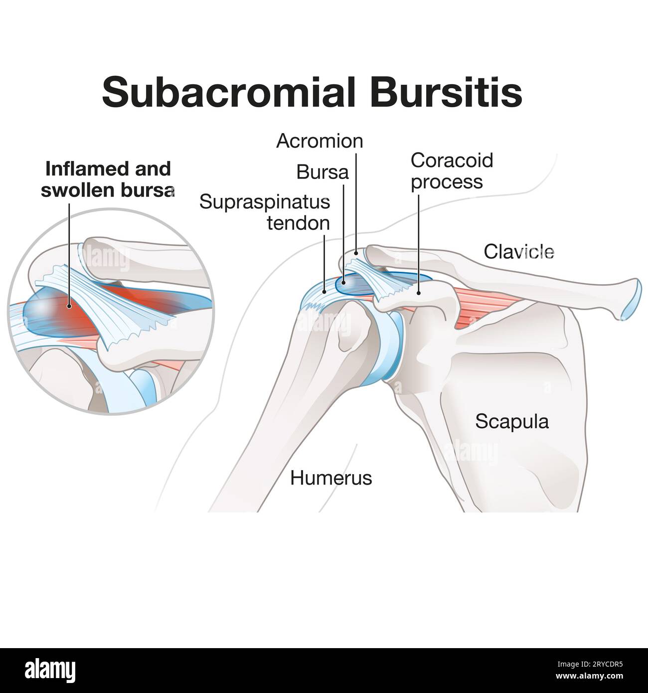 Bursa Shoulder Ligament Injuries Innova Pain ClinicInnova Pain 