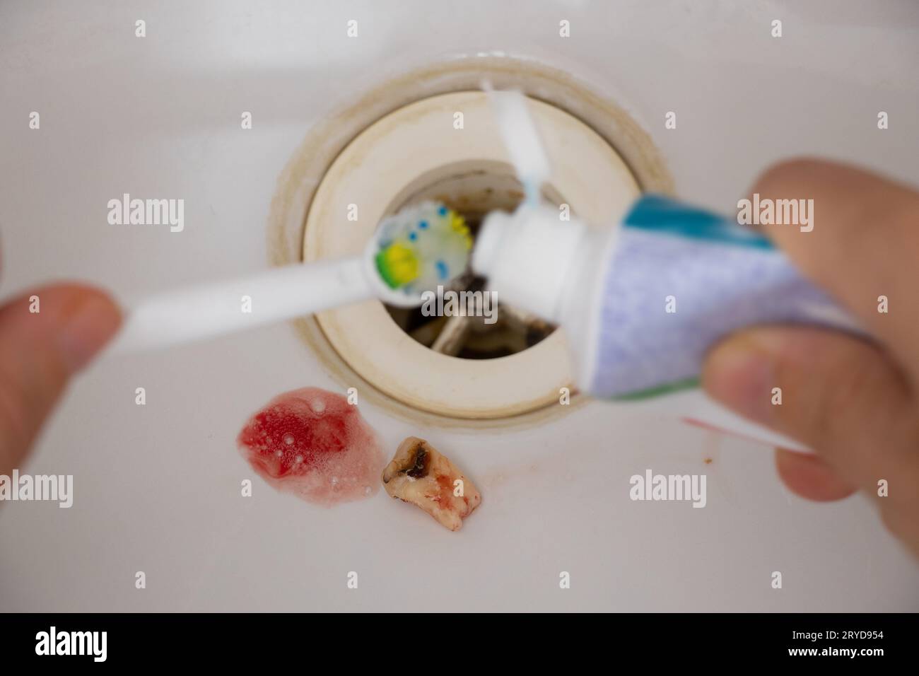 An extracted tooth with blood lies in the bathroom sink against the background of a toothbrush and toothpaste, dental care and brushing teeth, dentist Stock Photo