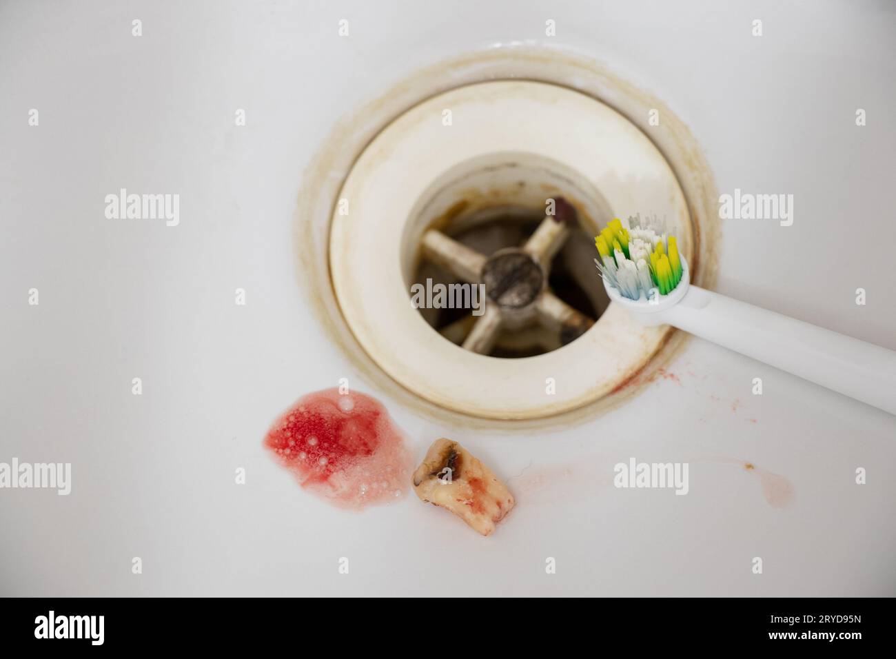 An extracted tooth with blood lies in the bathroom sink and a toothbrush, dental care and teeth cleaning, dentistry, tooth extraction Stock Photo