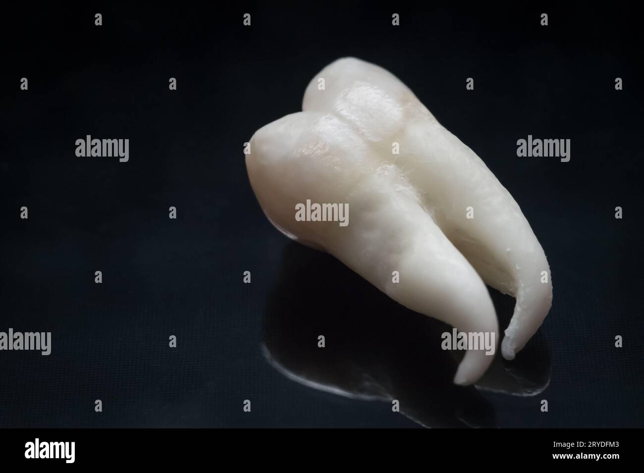 Tooth wisdom teeth human hi-res stock photography and images - Alamy