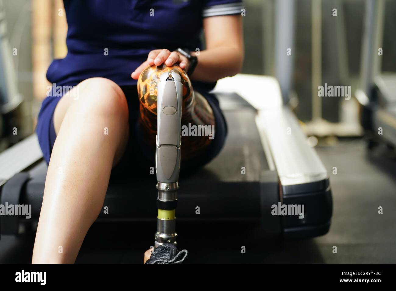 Young female with one prosthetic leg with the practice of using prosthetic legs to walk, exercise and and daily activities Stock Photo