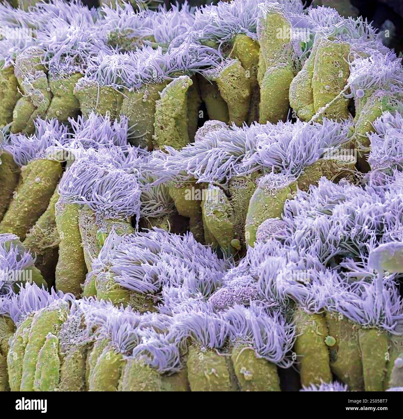 Nasal epithelium, coloured scanning electron micrograph (SEM). The ...