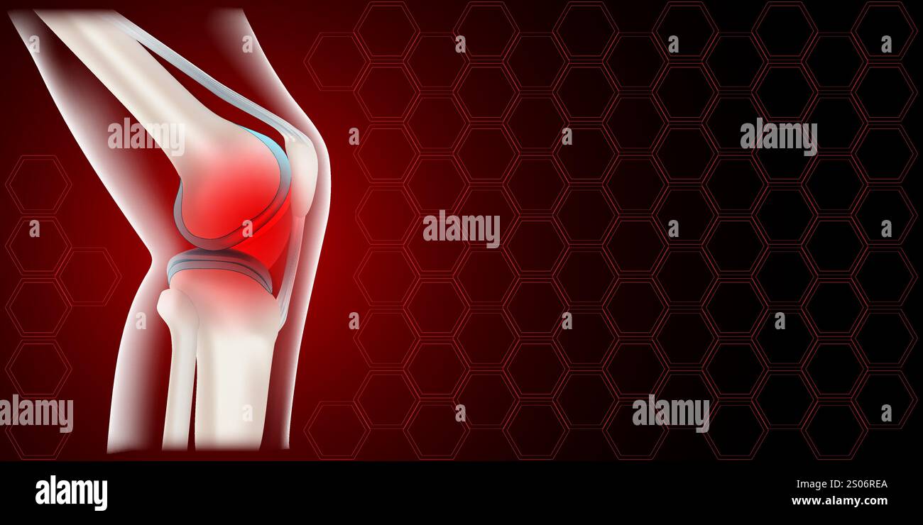 Knee joint pain or inflammation. Realistic human knee on red background ...