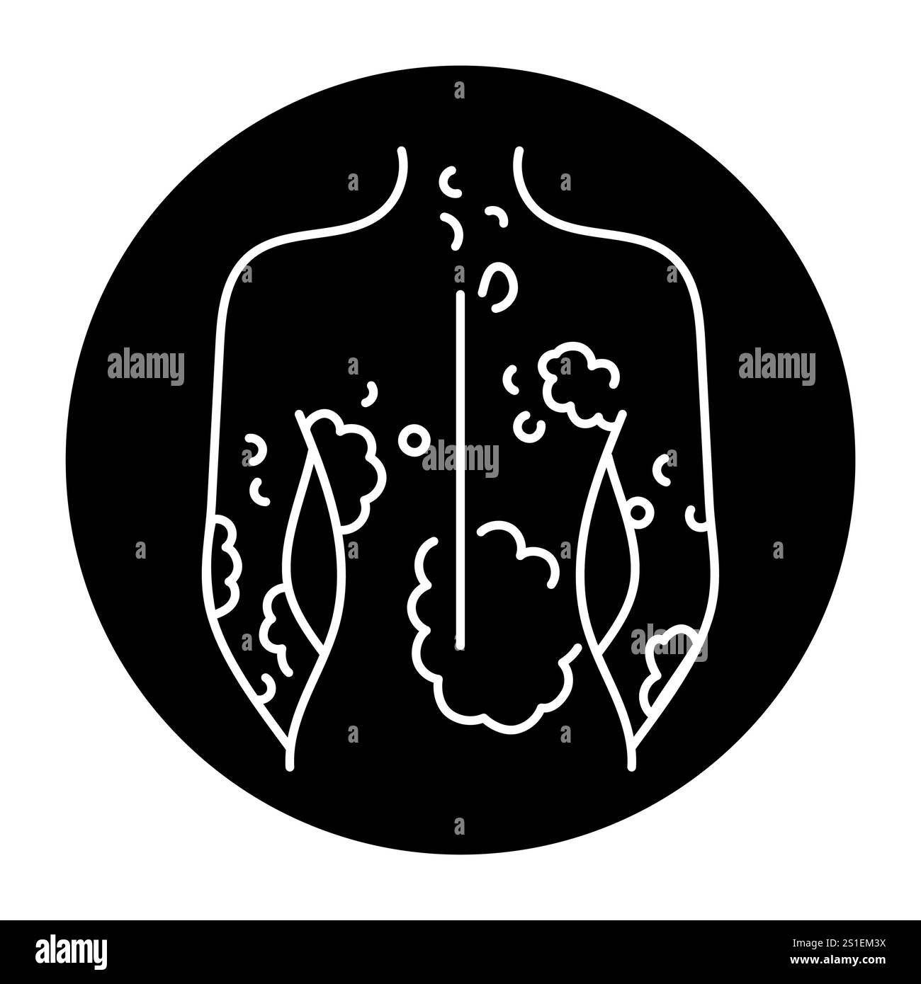 Psoriasis color line icon. Autoimmune diseases. Vector isolated element. Editable stroke. Stock Vector