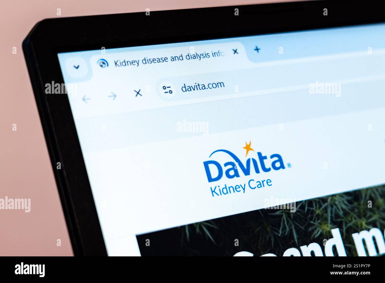 New York, USA January 01, 2025 DaVita Kidney Care website displayed(02)