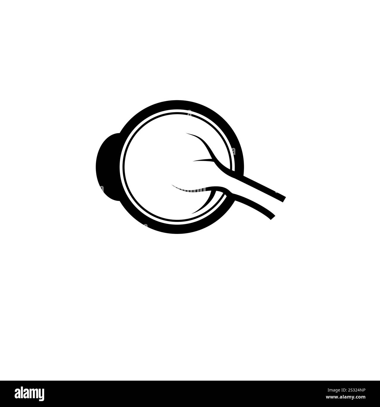 Human Eyeball, Cataract Treatment Solid Flat Vector Icon Isolated on ...