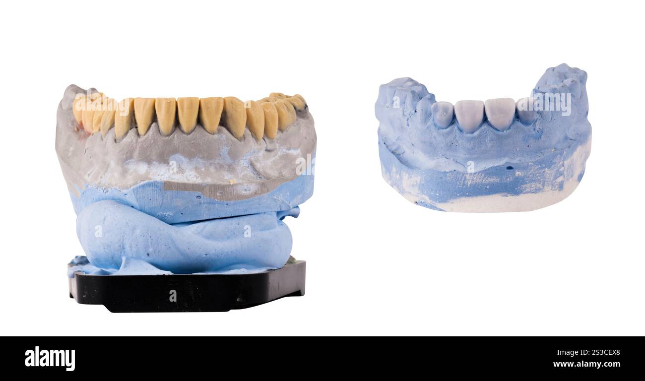 the jaw isolated on white background Stock Photo - Alamy
