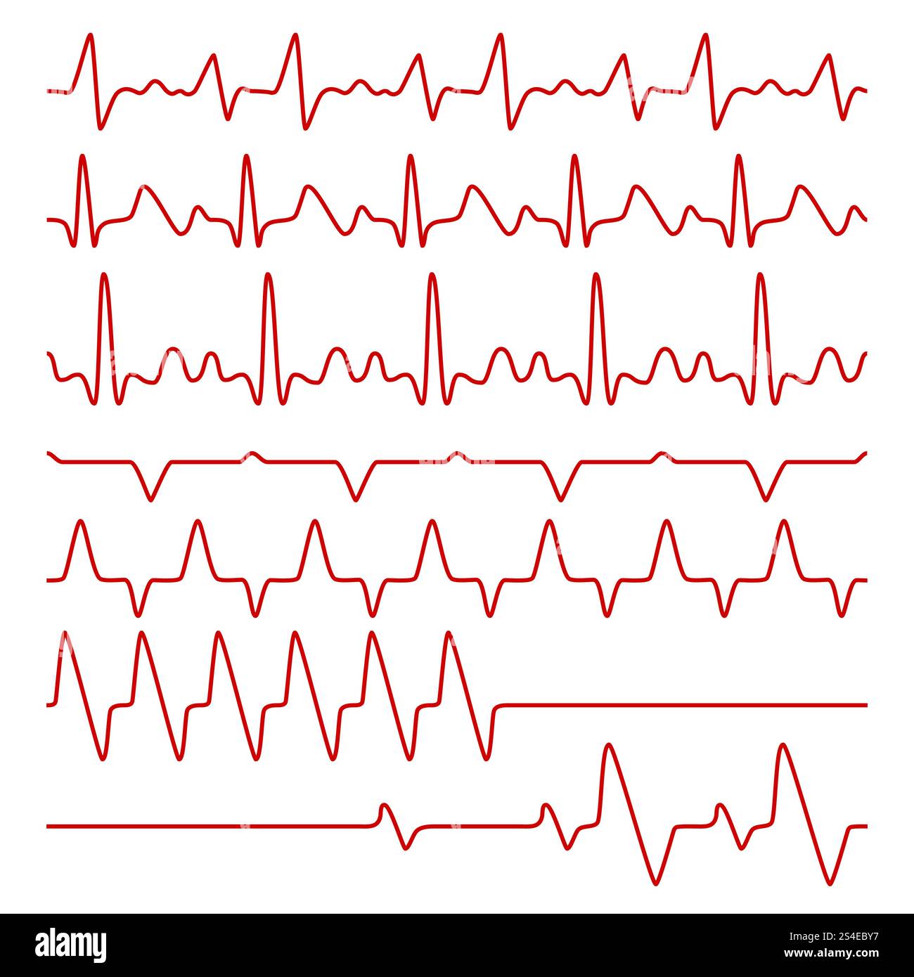 Line vector cardiograms or electrocardiogram on monitor, heartbeat ...