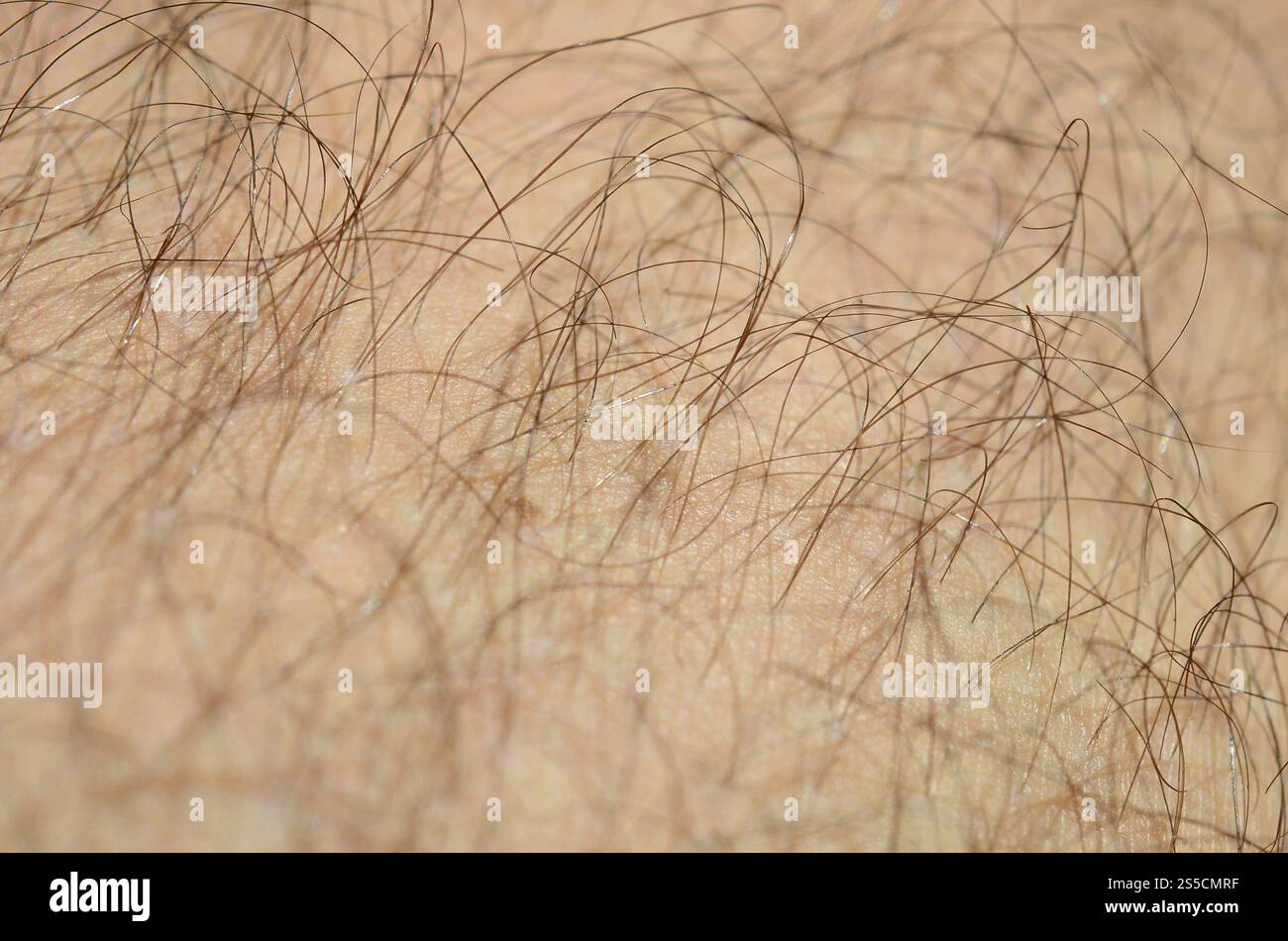 Close up detail of human skin with hair. Mans hairy leg Stock Photo