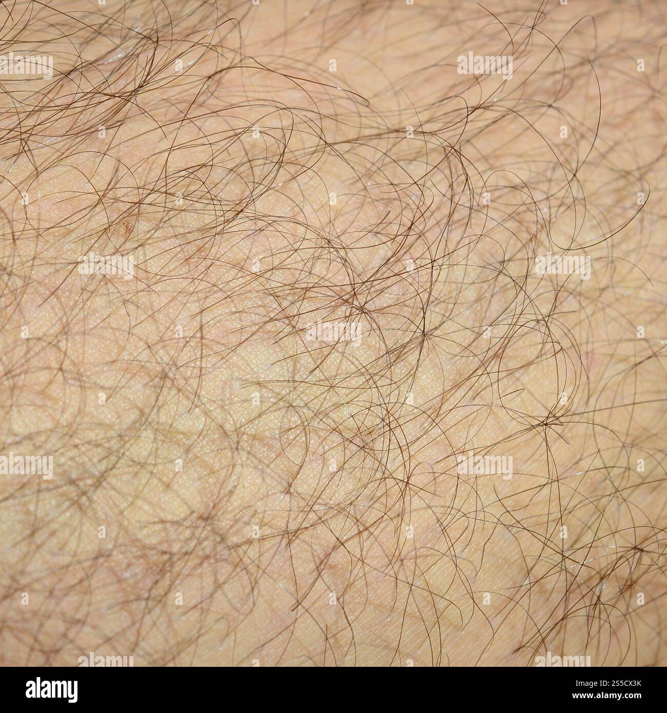 Close up detail of human skin with hair. Mans hairy leg Stock Photo