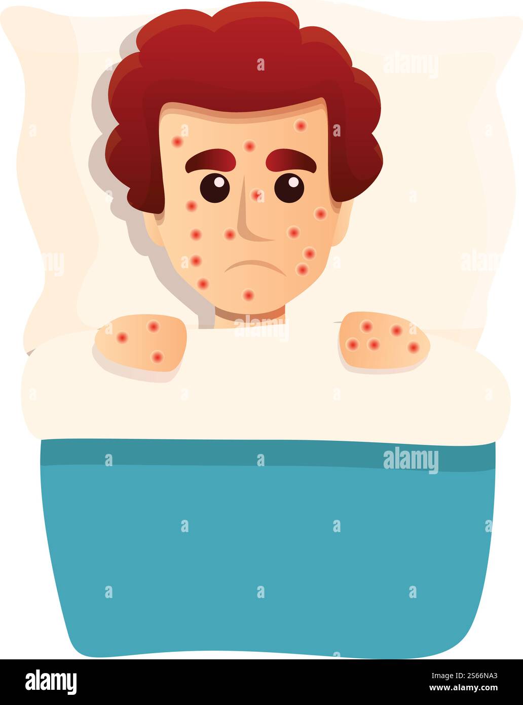 Chicken pox patient icon. Cartoon of chicken pox patient vector icon ...