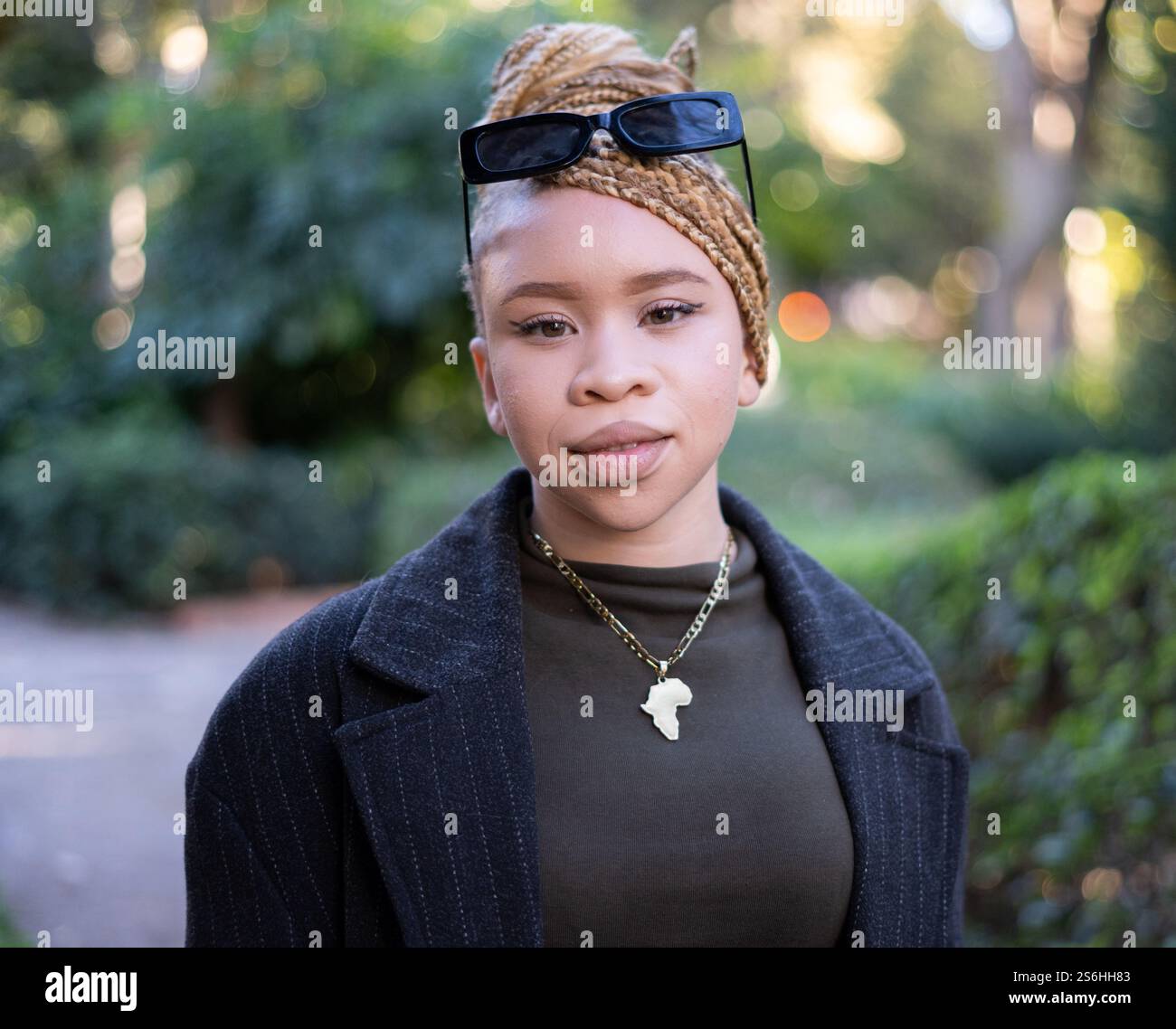 Albinism eyes hi-res stock photography and images - Alamy