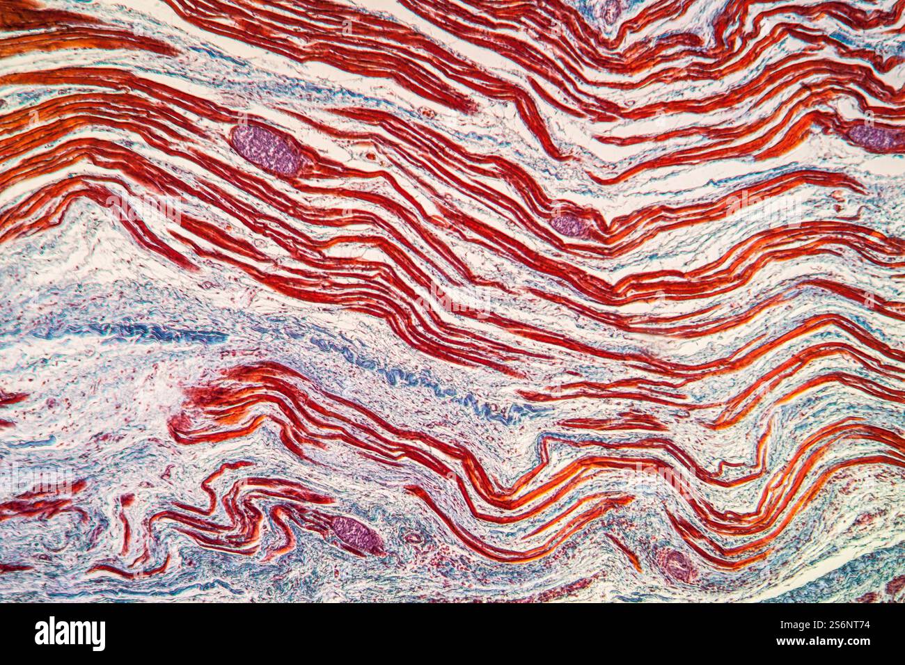 Tapeworm parasite in muscle 100x Stock Photo