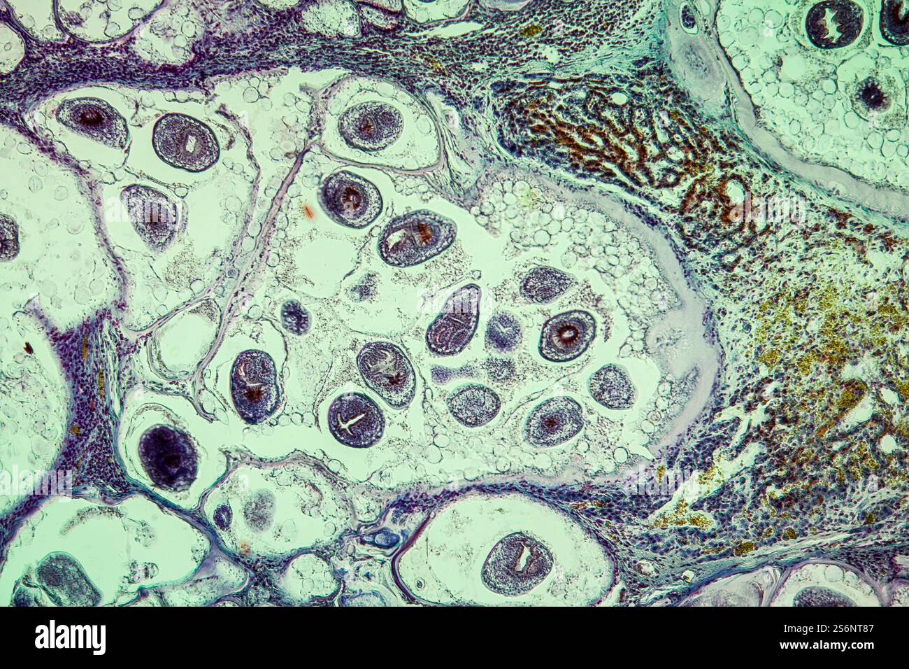 Worms in infected liver 100x Stock Photo