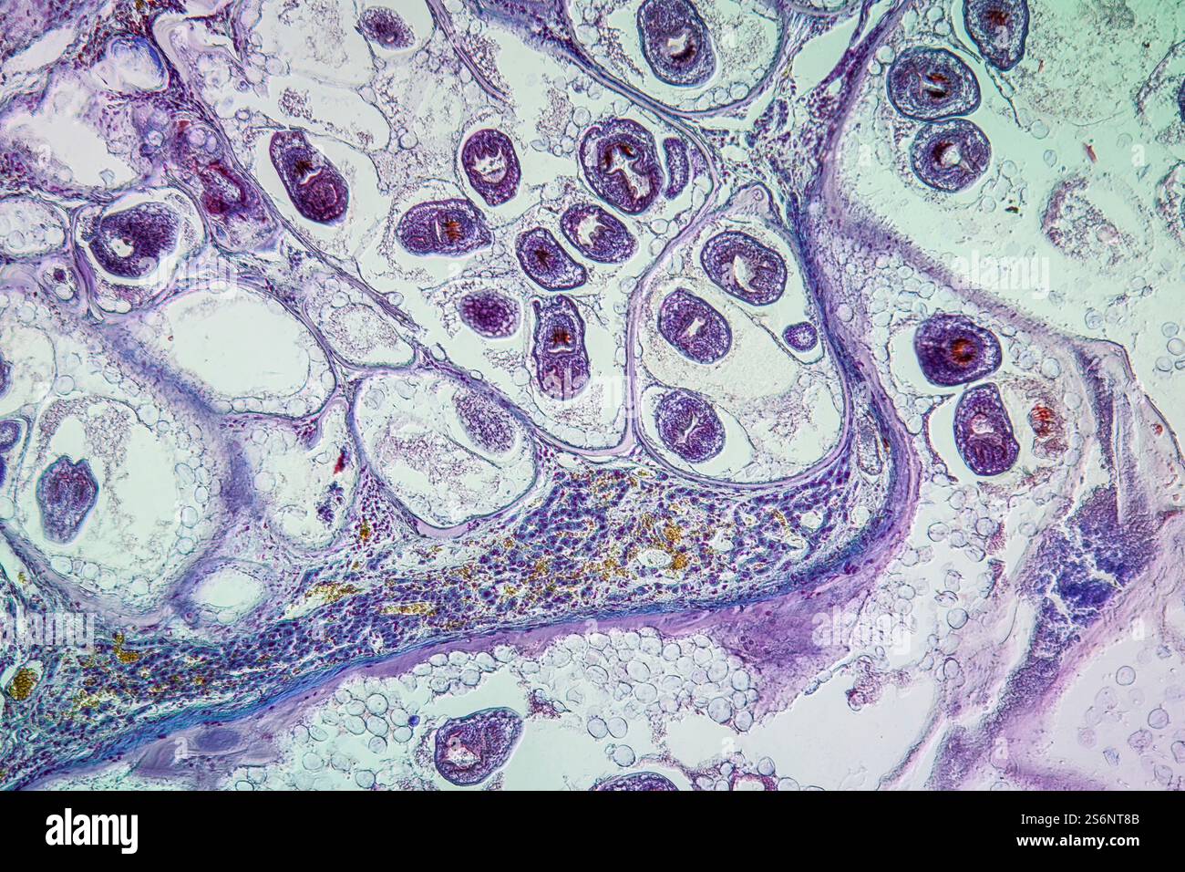 Worms in infected liver 100x Stock Photo