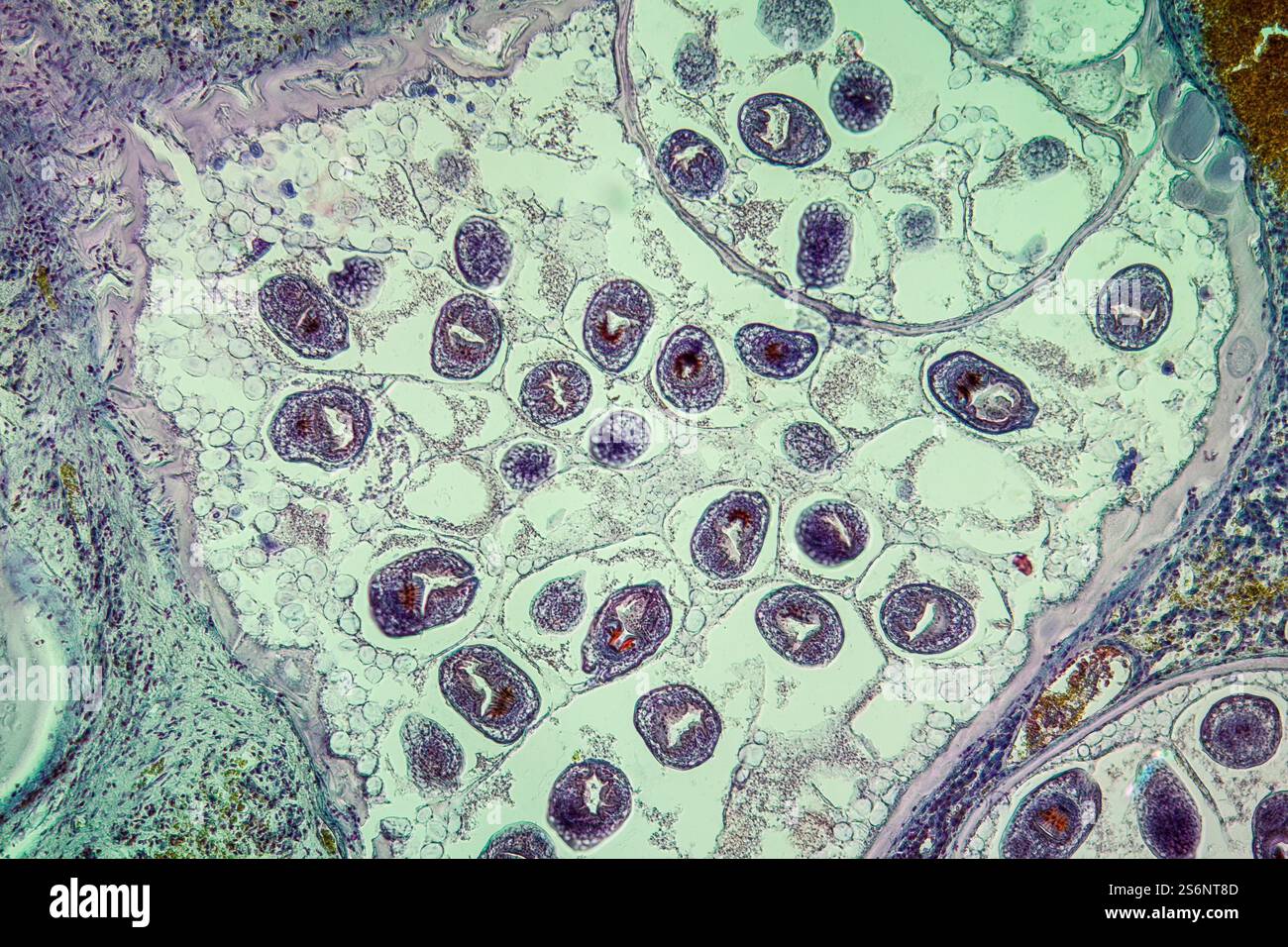 Worms in infected liver 100x Stock Photo