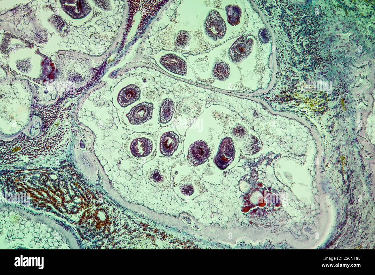 Worms in infected liver 100x Stock Photo