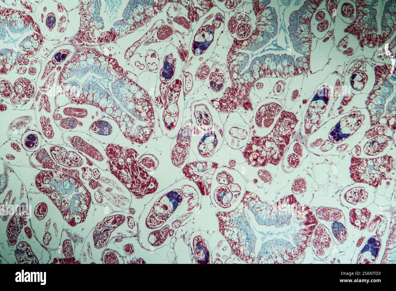Infection with liver fluke 100x Stock Photo - Alamy
