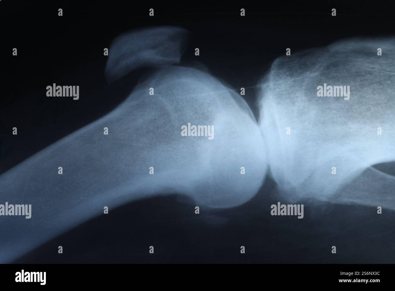 X-ray image of knee joint as background, closeup Stock Photo - Alamy
