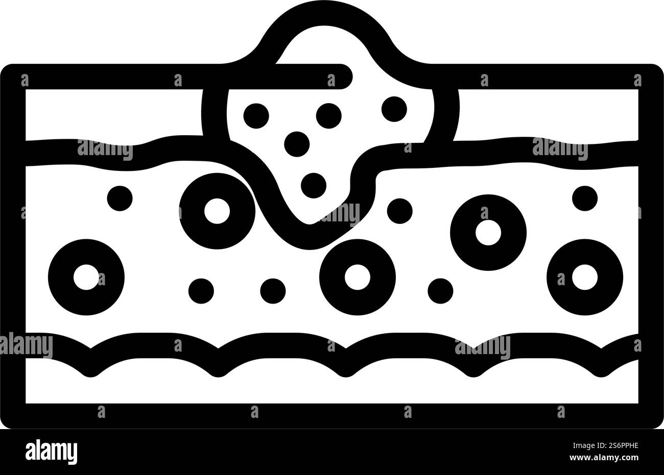 Abstract problem skin disease Black and White Stock Photos & Images - Alamy