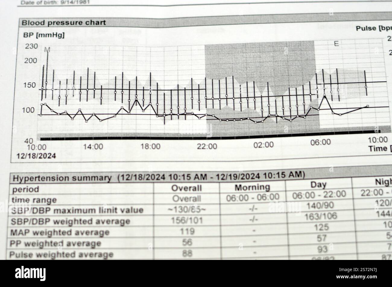Cairo, Egypt, December 24 2024: 24 hours ambulatory blood pressure ...