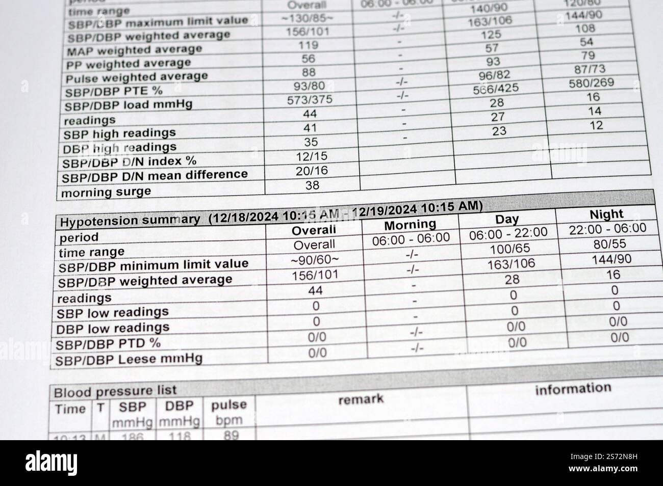 Cairo, Egypt, December 24 2024: 24 hours ambulatory blood pressure ...