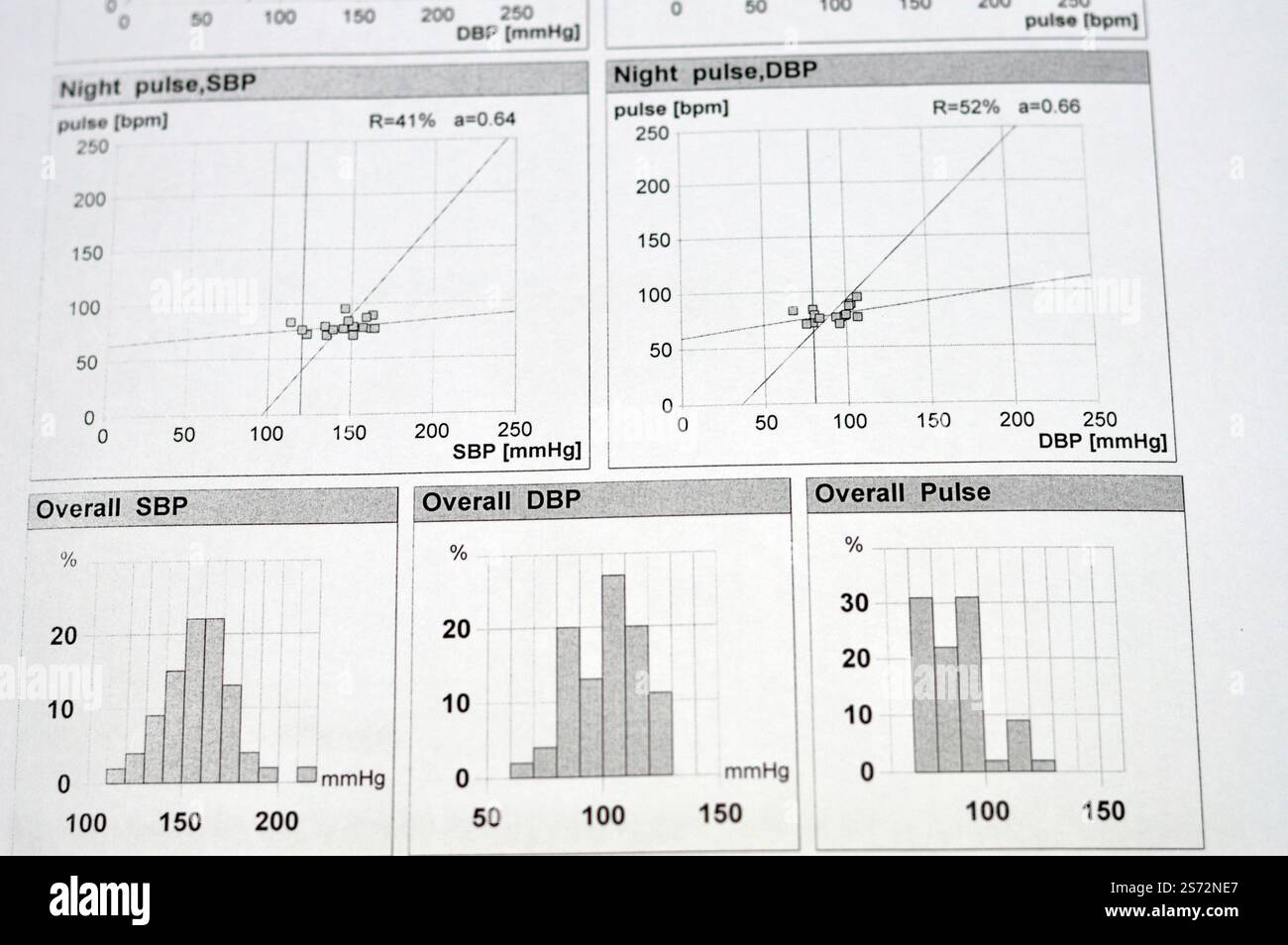 graphs from a 24 hours ambulatory blood pressure monitoring revealed ...