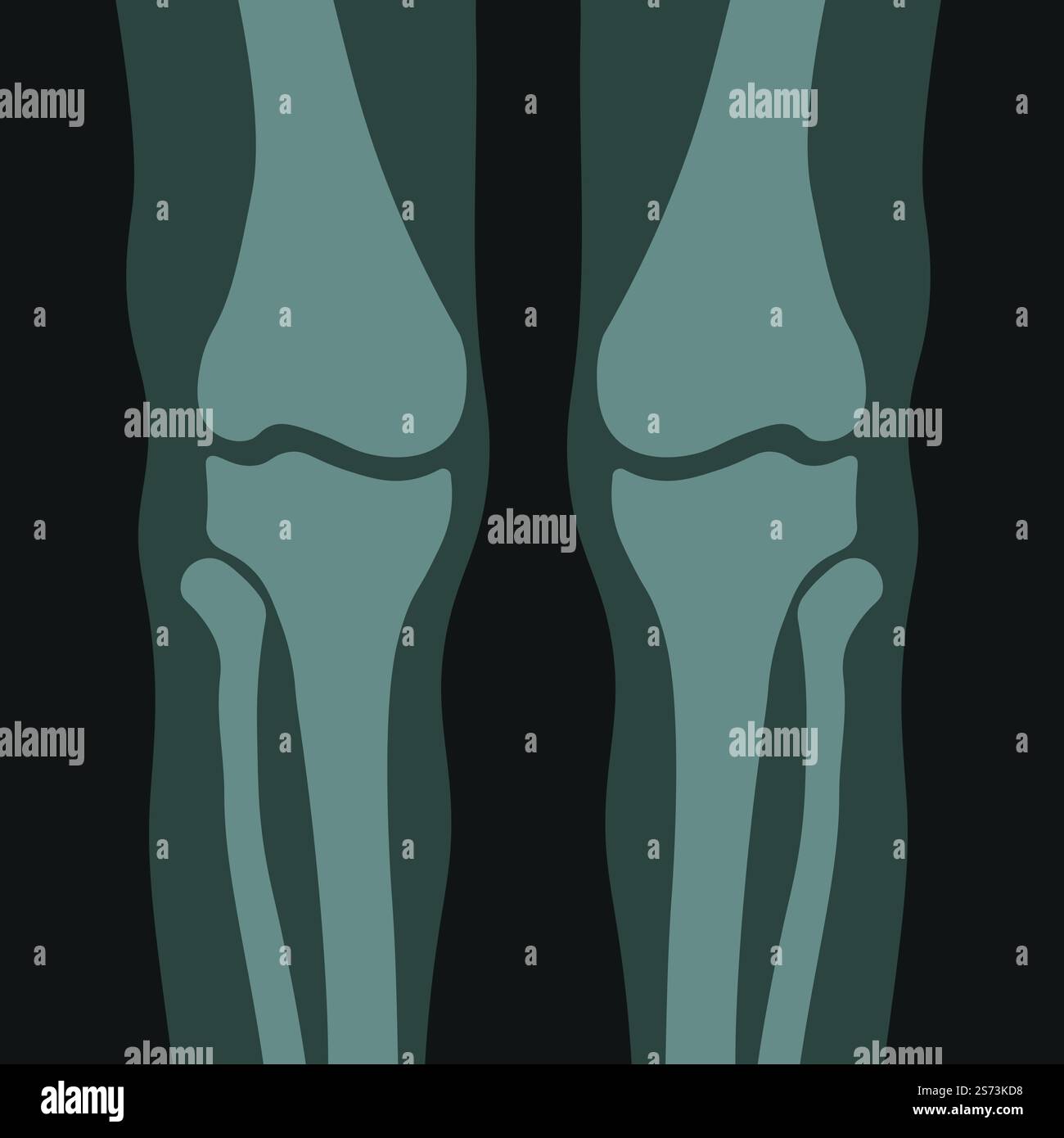 Scan of human knees bones and joints, examination and diagnosis with ...