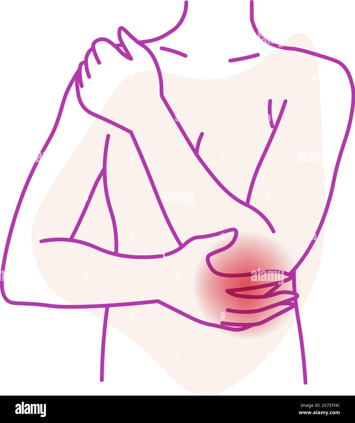Overuse of the elbow causes elbow aches. Arthritis or injury of joint ...