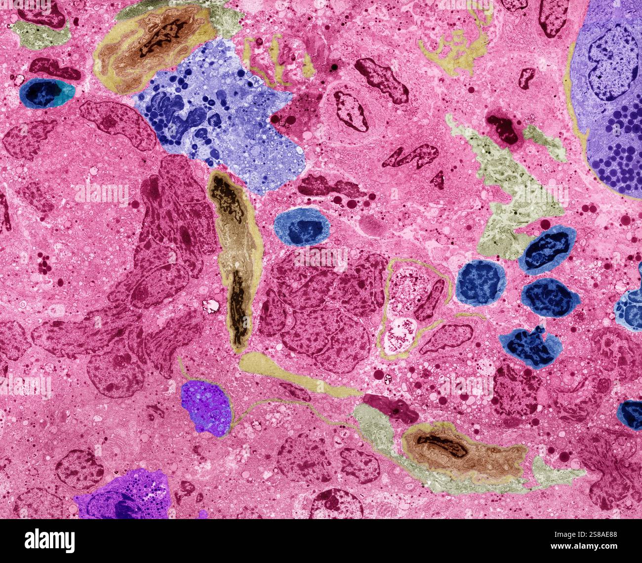 Pancreatic tissue. Coloured transmission electron micrograph (TEM) of a ...