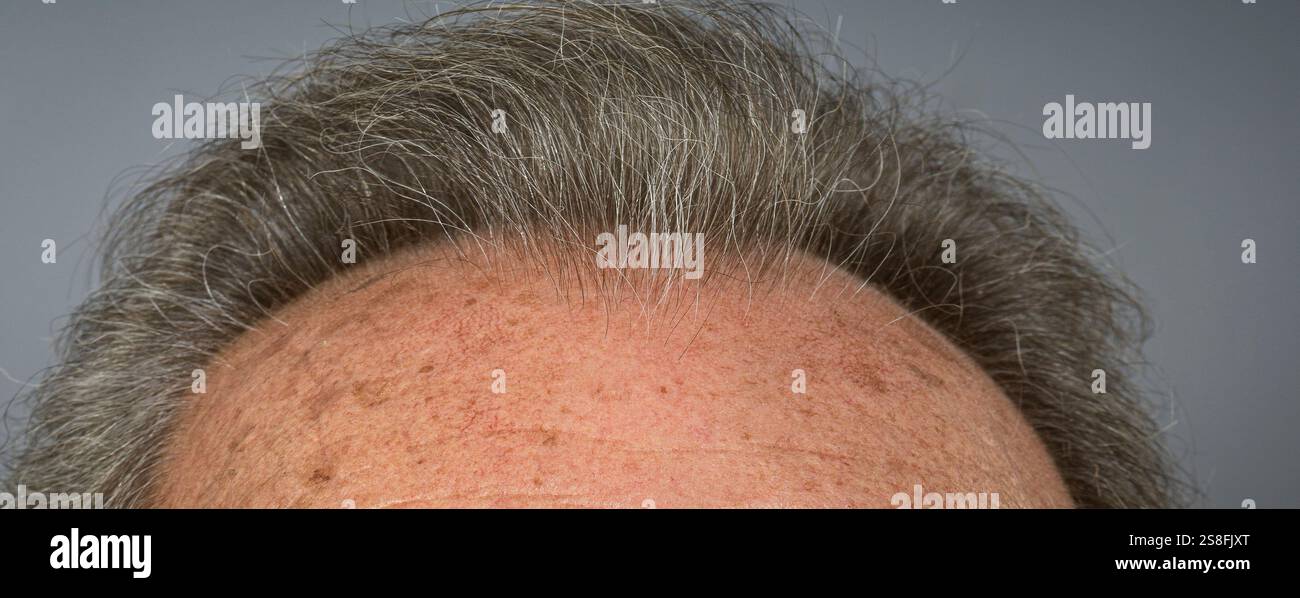 Old man bald head hi-res stock photography and images - Alamy