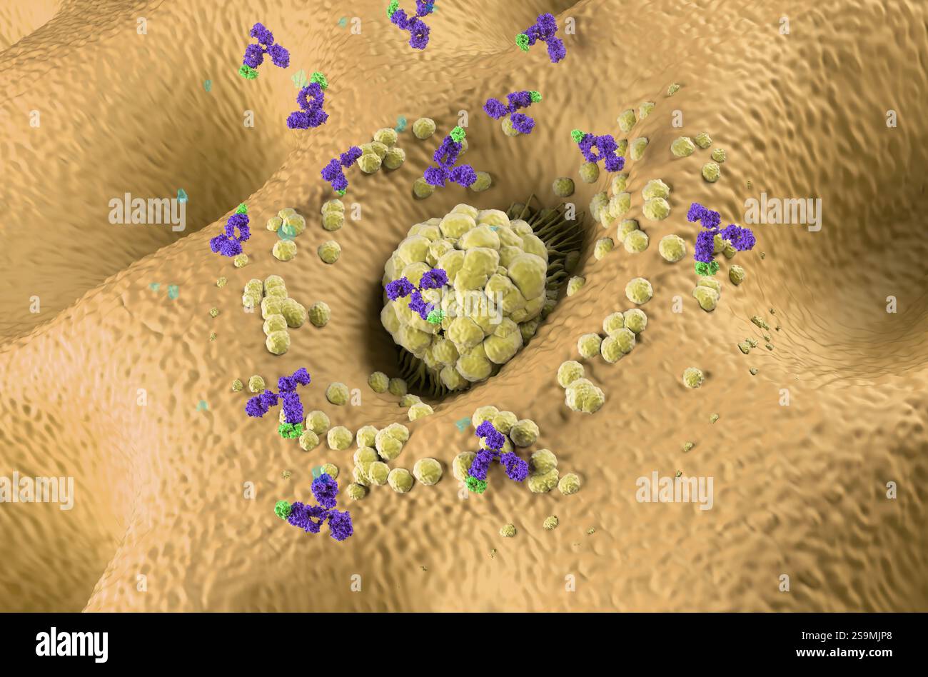 Gastric cancer antibody hi-res stock photography and images - Alamy