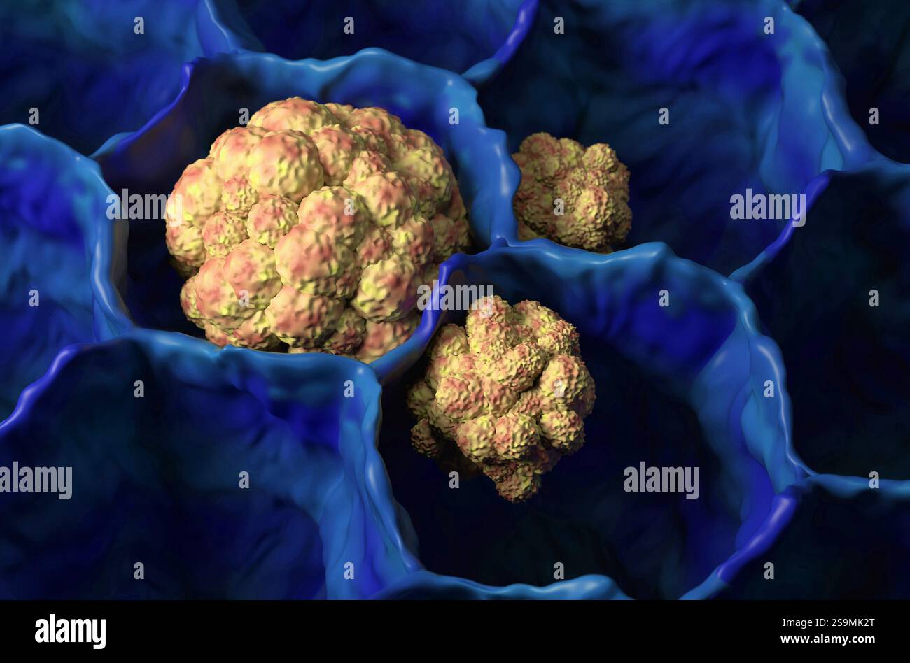 Monoclonal antibody melanoma hi-res stock photography and images - Alamy