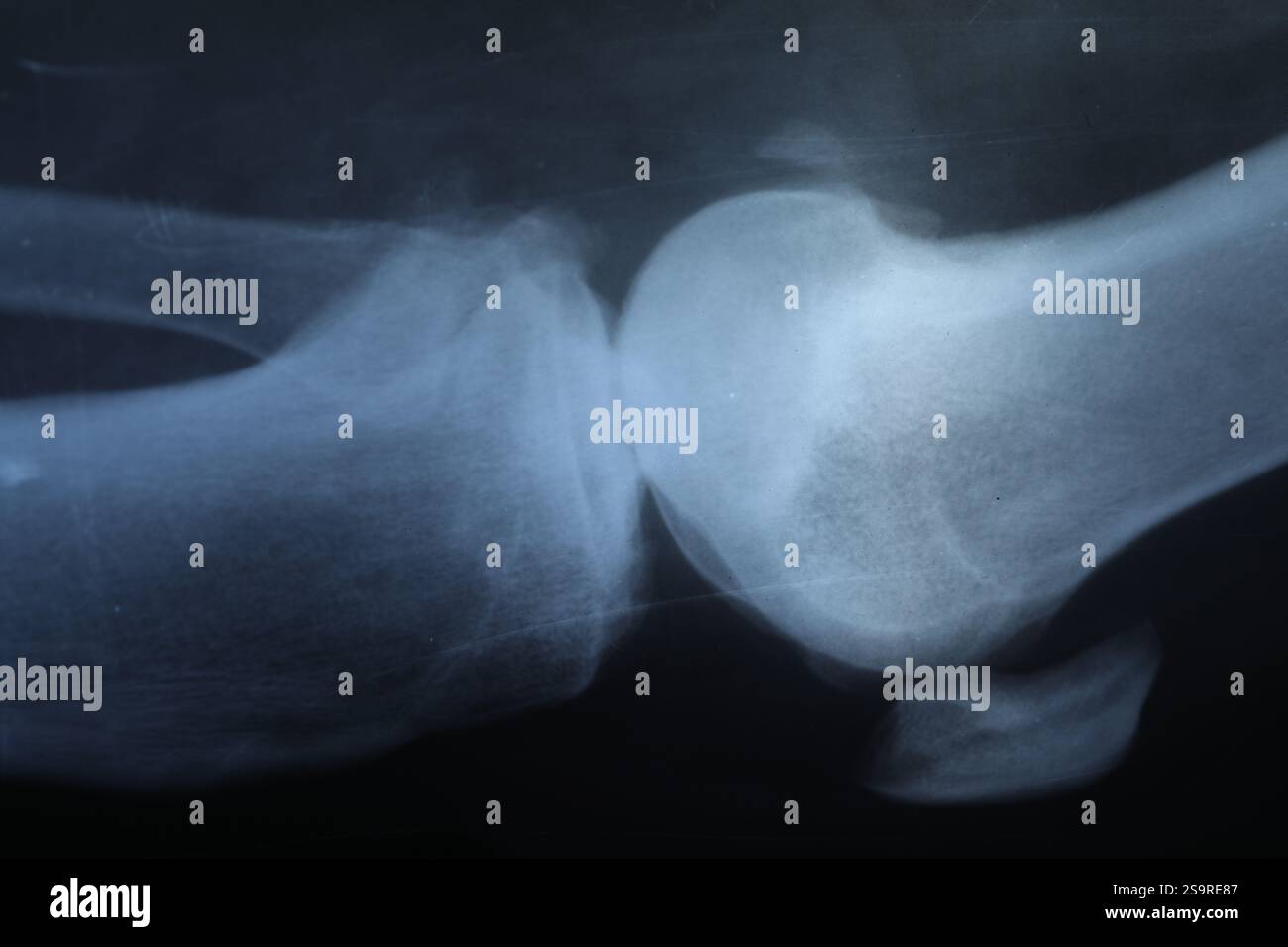 X-ray image of knee joint as background, closeup Stock Photo - Alamy
