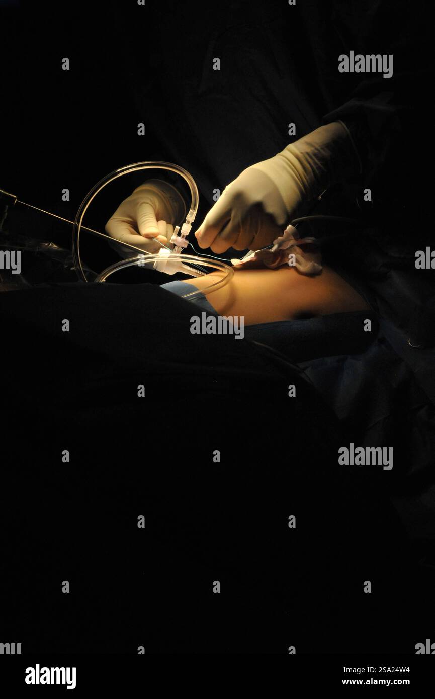 Operating room in pediatric surgery on a child. Pediatric surgery ...