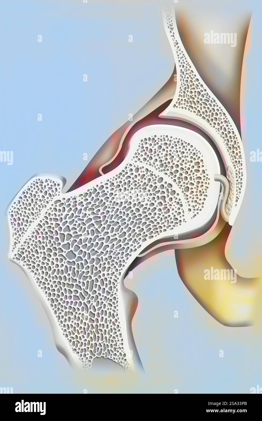 Coxofemoral joint and femoral neck. Hip drawing 016238 052 Stock Photo