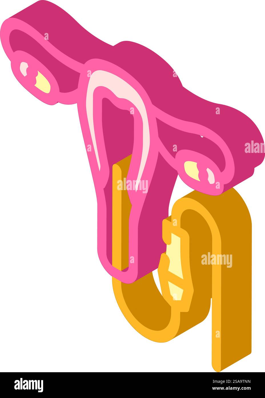 Hysteroscopy Surgery Isometric Icon Vector Hysteroscopy Surgery Sign