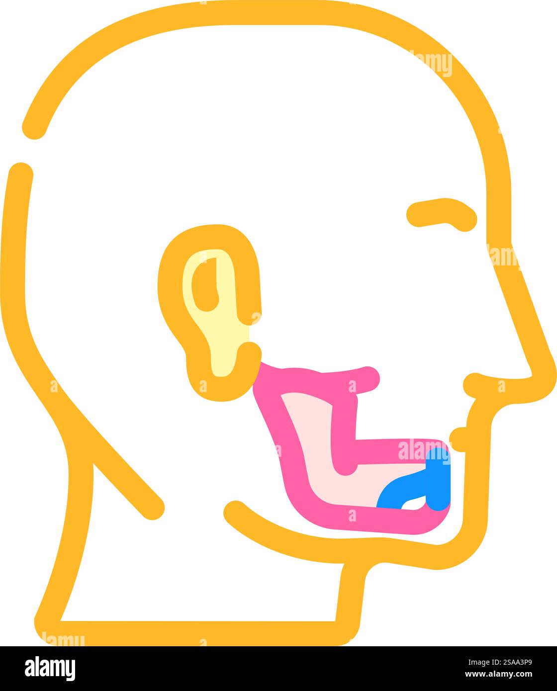 genioplasty surgery color icon vector. genioplasty surgery sign ...